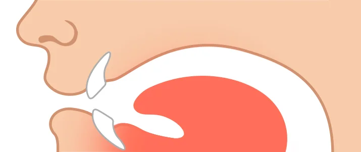 Tongue position: Neutral Tongue